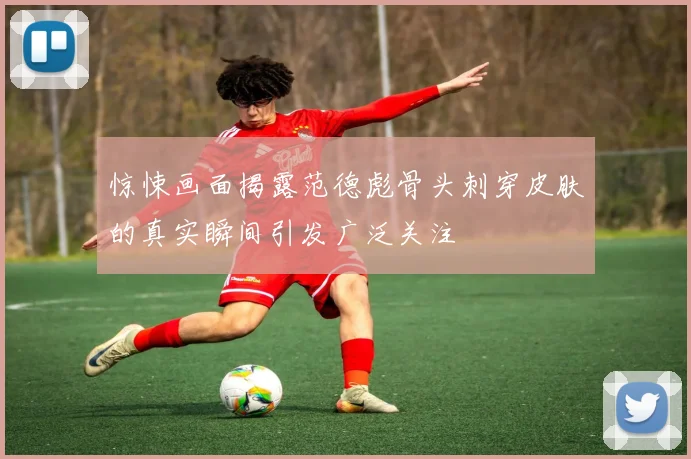 惊悚画面揭露范德彪骨头刺穿皮肤的真实瞬间引发广泛关注